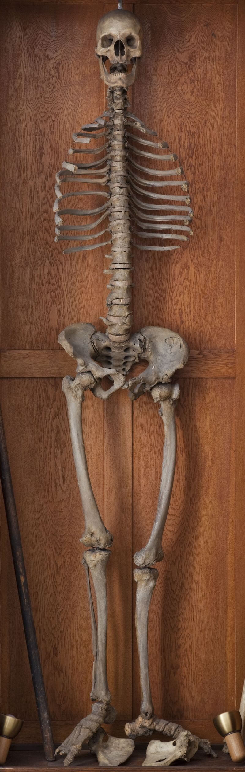 Skelett des „Langen Anton“, präpariert 1596/97 244 cm hoch Museum Anatomicum – Medizinhistorisches Museum, Philipps-Universität Marburg